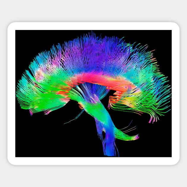 Brain pathways (P335/0069) Sticker by SciencePhoto